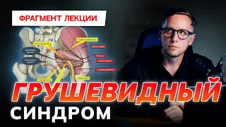 Груша не виновата! Грушевидный синдром в практике массажиста