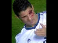 Download Lagu When Players Get Hurt + Ronaldo 🤯