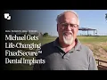 FixedSecure Upgrade to Non-Removable Implants in One Day