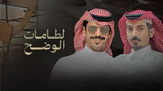 لطامات الوضح - جفران هضبان & تركي السلات - هدو اللعب ولا الجو ماهوب هادي 2025