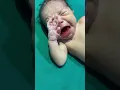 Download Lagu Little expression of new born #adorably #newbornbaby #adoreble #newborn #viralvideo