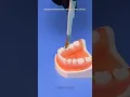 Download Lagu How tooth removal works at the dentist
