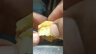                     دندنها