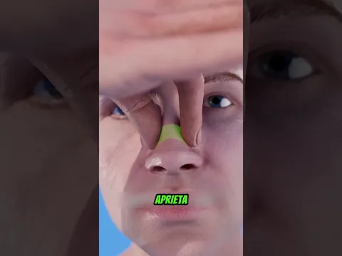 ¿Qué Debes Hacer Si Te Sangra la Nariz 🧐😨