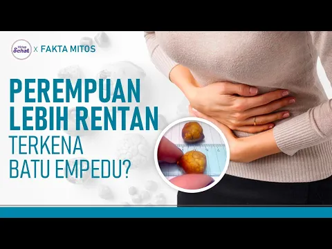 Ini Kenapa Perempuan Lebih Beresiko Terkena Batu Empedu