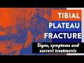 Tibial plateau fracture Signs symptoms and current treatments