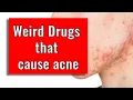 Weird drugs that cause acne