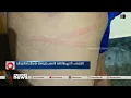 സഹപാഠിയോട് സംസാരിച്ചതിന് വിദ്യാർത്ഥിയെ അധ്യാപകൻ മർദിച്ചെന്ന് പരാതി