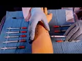 ASMR Allergy Testing Intradermal Test Skin Exam Writing on You