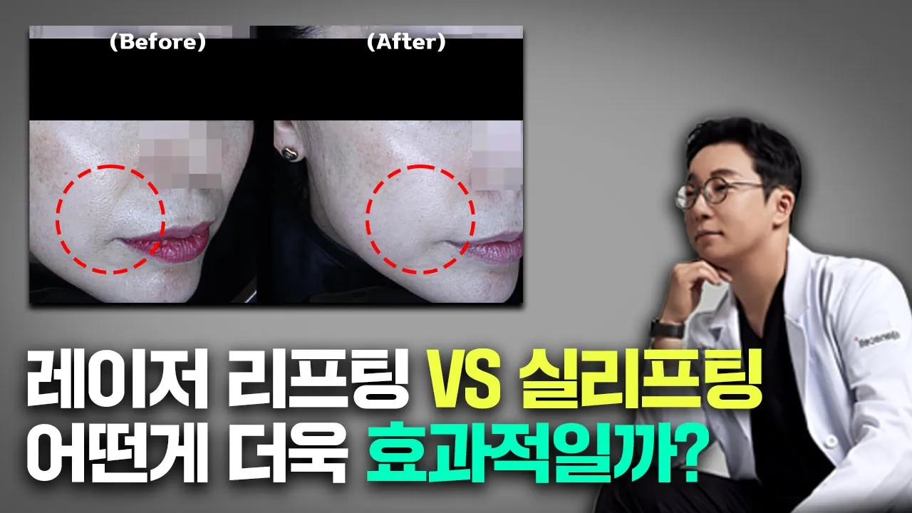 노화가 급격히 진행되는 50~60대 중년층에게 가장 효과적인 리프팅은??