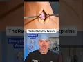 Download Lagu Placing a Neck Breathing Tube 😱 #shorts