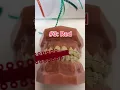Braces colors that ll make you teeth look