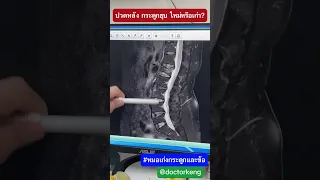  กระดูกยุบใหม่กับกระดูกยุบเก่าต่างกันอย่างไร และจะรู้ได้อย่างไรว่าเป็นการยุบใหม่ 