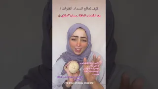 ملف الرضاعه انسداد قنوات الحليب كتلة في الثدي الفيديو رقم ٤٤ القابلة حسناء قطعة سكر 