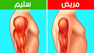 ضمور العضلات  لا تتجاهل   علامات مبكرة  دندنها
