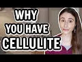 WHY YOU HAVE CELLULITE HOW TO GET RID OF IT Dermatologist DrDrayzday
