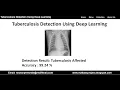 Tuberculosis Detection Using Deep Learning Tuberculosis Detection Using Python Project Code