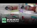Rare identical quadruplets born in Australia