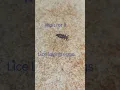 Download Lagu Lice removal | live lice egg laying | gross 🤢 | subscribe for more