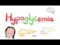 Low blood sugar Hypoglycemia - Endocrinology Series