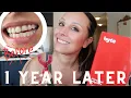 BYTE ALIGNERS REVIEW 1 year update byte and pregnancy