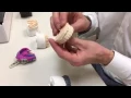 Prepless Veneers Vancouver BC Dentist