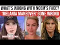 Kristi Noem s BOTOX FAIL Shocks America MAR-A-LAGO FACE Blows Up As Plastic Surgeon Reacts