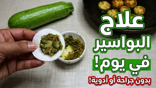 لا  أدوية لا جراحة ! القرع يعالج البواسير في أول يوم / وصفة سحرية خرافية