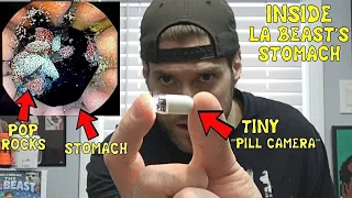 A Visual Look Inside L.A. Beast's STOMACH (Using A Camera Pill) | After Eating Pop Rocks & Coca Cola