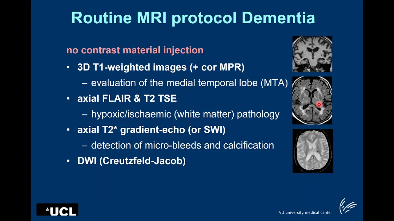 Imaging in AD_latest developments, Frederik Barkhof