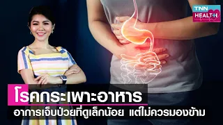 การรักษาโรคกระเพาะอาหารมีวิธีใดบ้าง