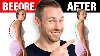 The TRUTH About Rounded Shoulders: It's Not Just Tight Muscles!