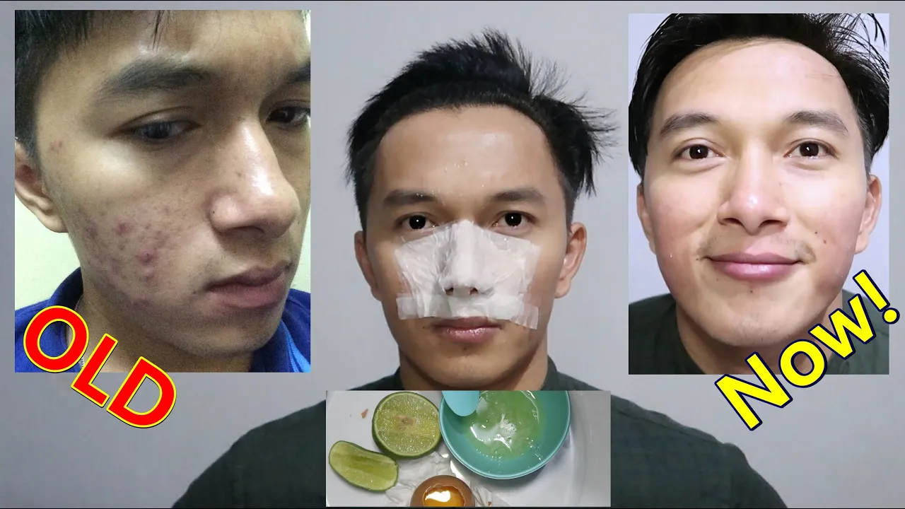 
          
          
          
            
            Dari & Untuk PEJUANG JERAWAT!!! Masker putih telur + Jeruk Nipis
          
        . 