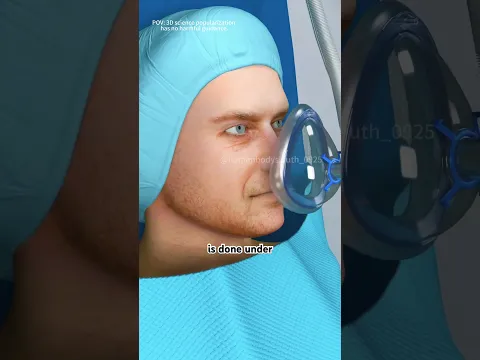 Scoliosis Surgery (3D Animation) #3dmedicalanimation #doctor #nosebyrohrich #facts #science