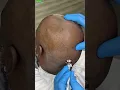 Mega Satisfying Dry Scalp Facial Massage