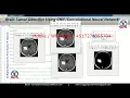 Brain Tumor Detection Using CNN Convolutional Neural Network Brain Tumor Detection Using Matlab