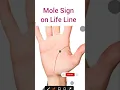 Mole Sign on Palm Palmistry by ThePalmIQ