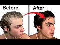 How To Stop Balding Full hair loss guide