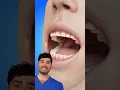 Download Lagu How to Fix Teeth!?