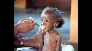 Alpha Blondy Ça Me Fait Si Mal Music Video 