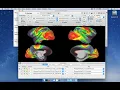 2 wb - view Surface View Basics
