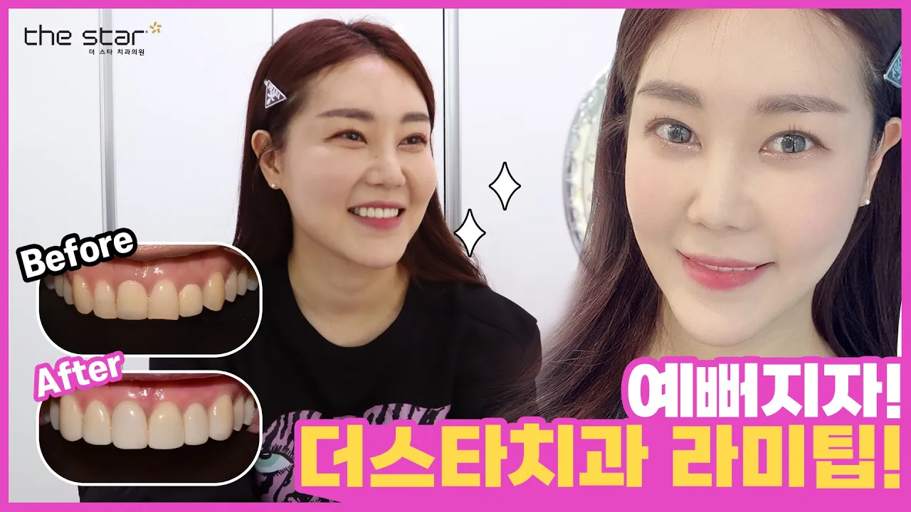 ✨간단하게 붙이는 무삭제 라미팁   🤟