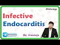 Download Lagu 7: Infective Endocarditis : Pathology USMLE Step 1