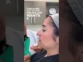 Download Lagu Lip filler with a natural result