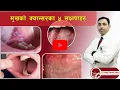 Protect Yourself: Recognize These 5 Warning Signs of Oral or Mukh Cancer! | Dr. Prabhat Thakur