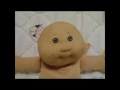 A Cabbage Patch kid infected with pox