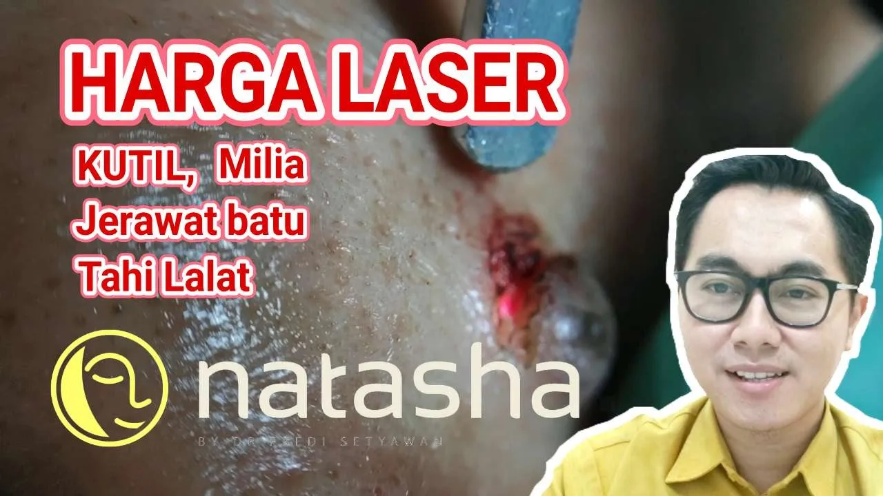Kalian tidak salah lihat thumbnail dan judul. Sebab memang kadang kami berikan free ongkir saat mome. 