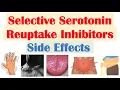 SSRI Antidepressant Side Effects Why They Occur Fluoxetine Paroxetine Sertraline Citalopram