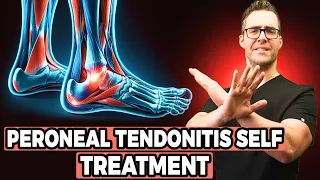 Download Peroneal Tendonitis Self Treatment [Stretches, Exercises \u0026 Massage] MP3