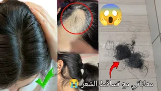 سر لي خلا شعري يتوقف من تساقط الشعر ويخلف بسرعة وبدون مجهود 
